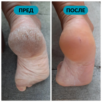 Електронски чистач за нозе